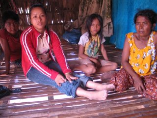 orphanage-no-finers-no-toes-6